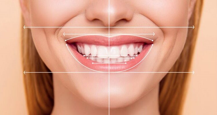 Cosmetic Smile Design