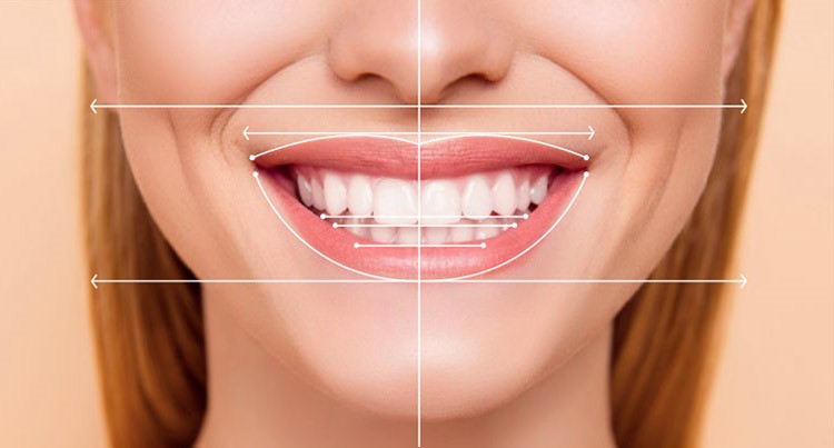 Cosmetic Smile Design