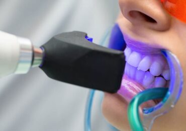 Teeth Whitening