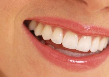 best-dental-clinic-in-turkey