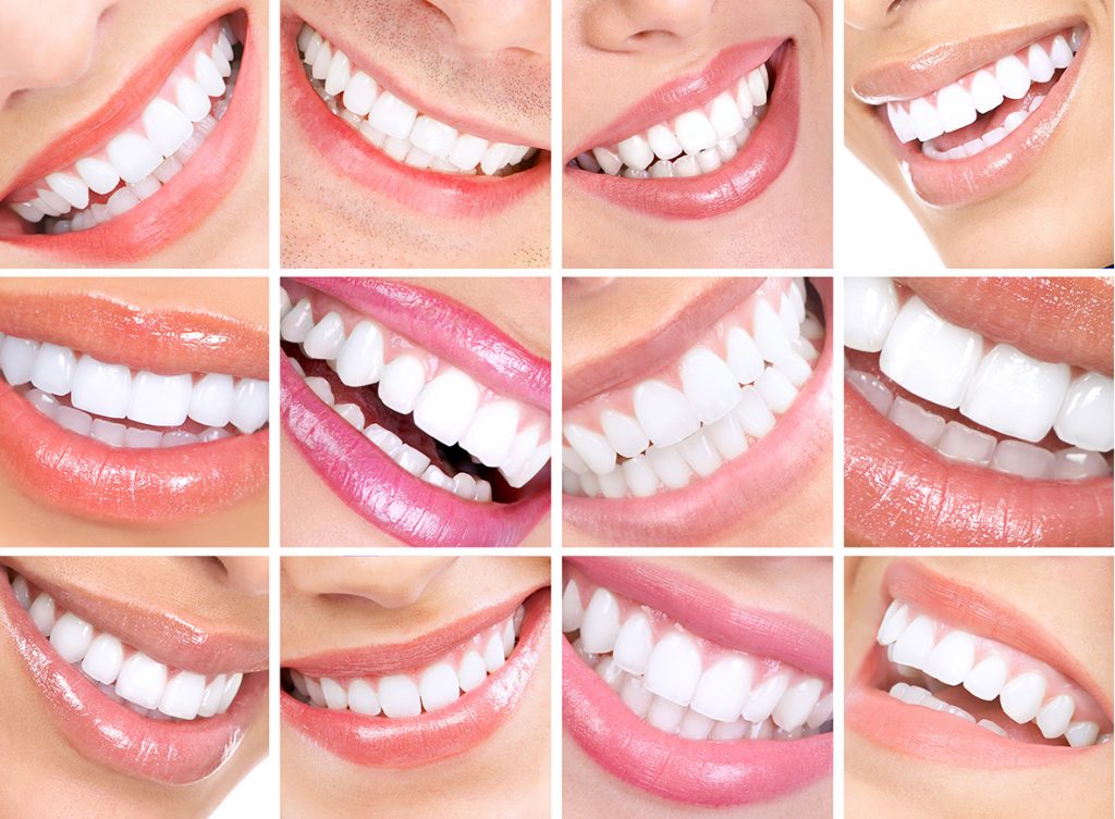 smile-makeover-in-turkey