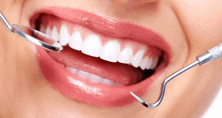 e-max veneers price in turkey