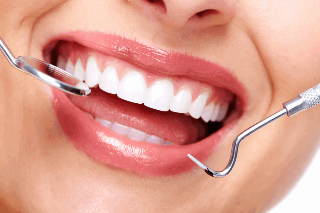 e-max veneers price in turkey