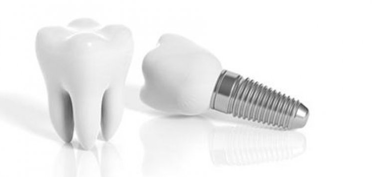 full mouth implants price in turkey