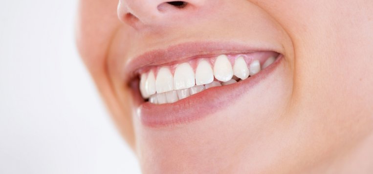 Teeth Whitening in Turkey
